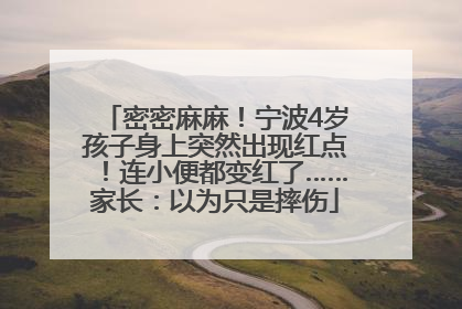 密密麻麻！宁波4岁孩子身上突然出现红点！连小便都变红了……家长：以为只是摔伤